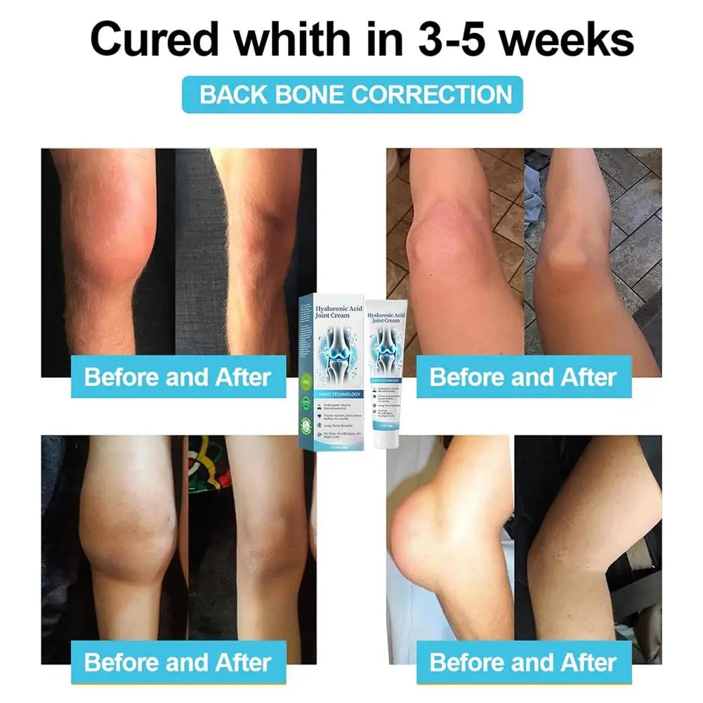 50g Hyaluronic Acid Joint Repair Cream for Pain Relief
