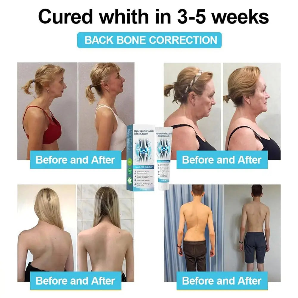 50g Hyaluronic Acid Joint Repair Cream for Pain Relief