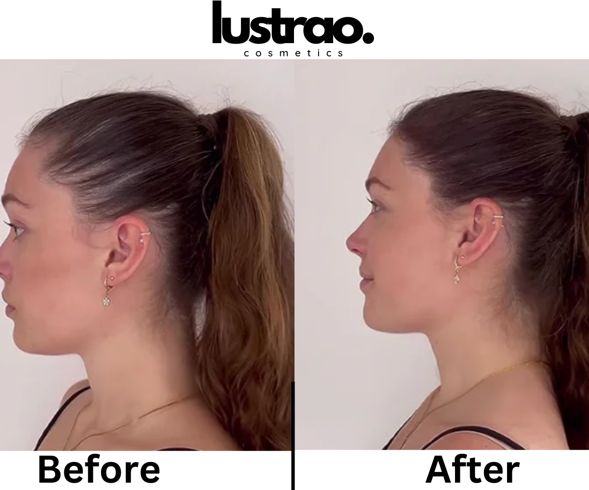 Lustrao Hair regrowth oil